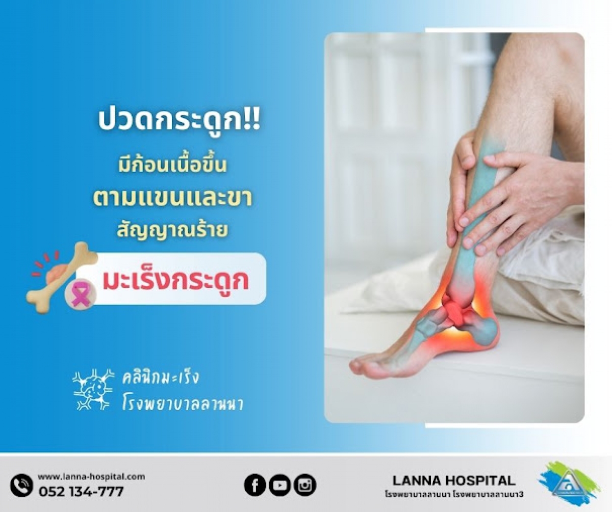 ปวดกระดูก มีก้อนเนื้อขึ้นตามแขนและขา สัญญาณร้าย มะเร็งกระดูก