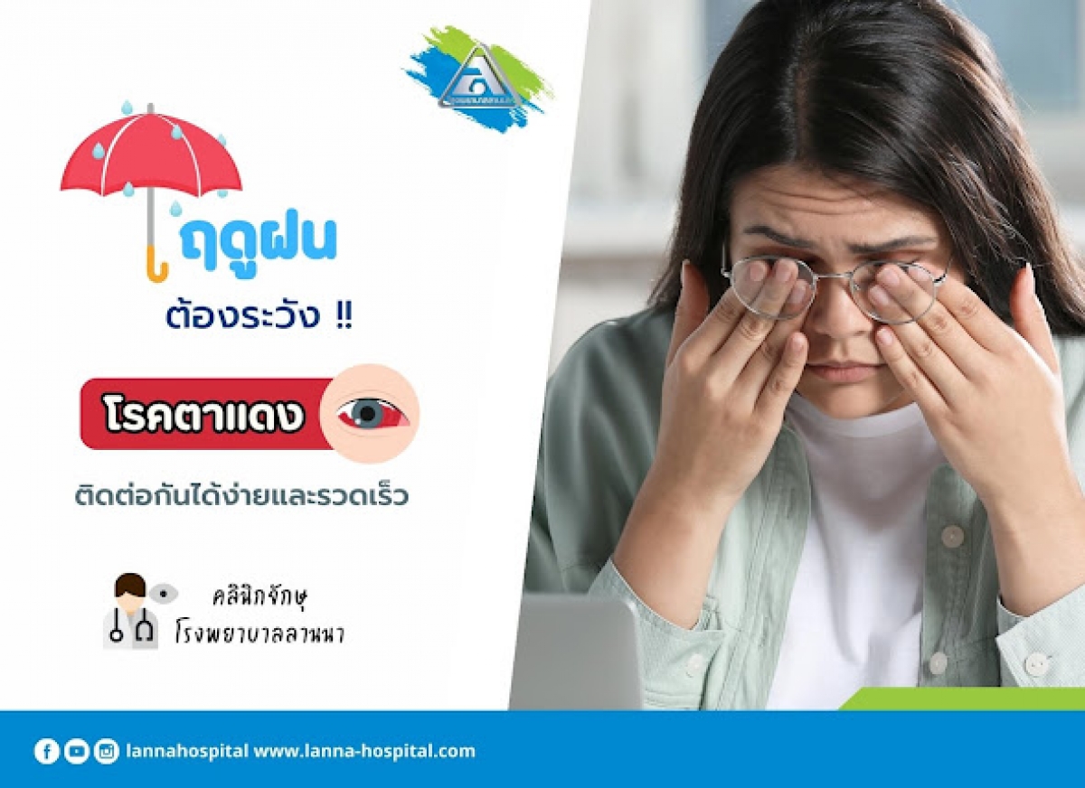  ฤดูฝนต้องระวัง  โรคตาแดง