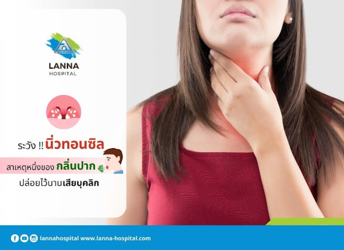 ระวัง!! นิ่วทอนซิล  สาเหตุหนึ่งของกลิ่นปาก ปล่อยไว้นานเสียบุคลิก